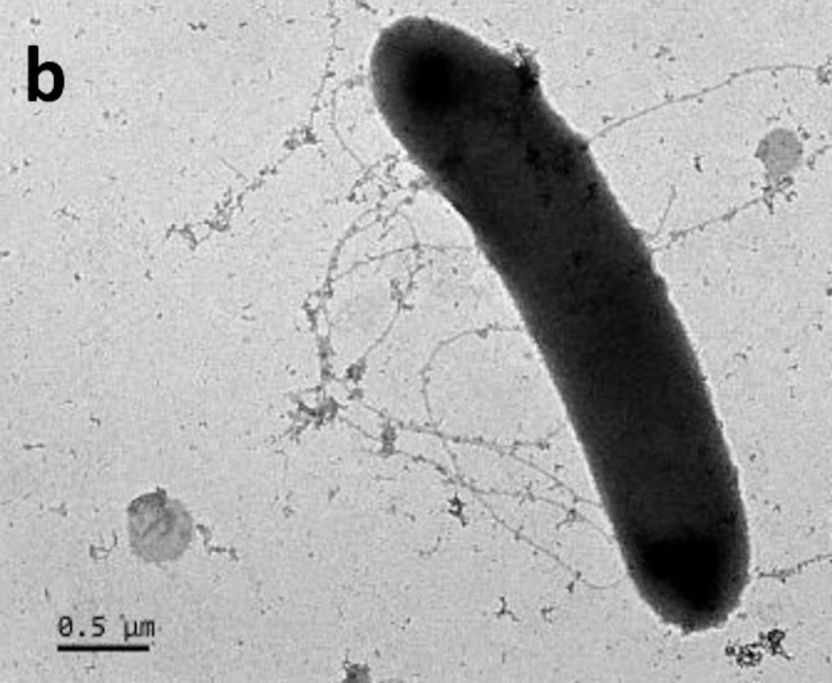 Бактерия R. inulinivorans усиливает мышечную силу пожилых